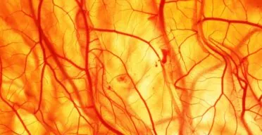 Stiff Collagen May Lead to Senescent Cells