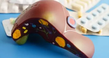 Organ Fat Is Associated With Carotid Atherosclerosis