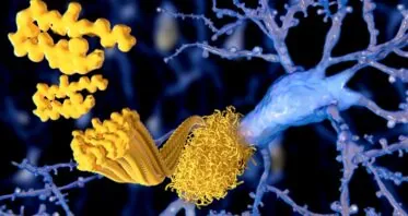 Arginine Reduces Signs of Alzheimer’s in Mice