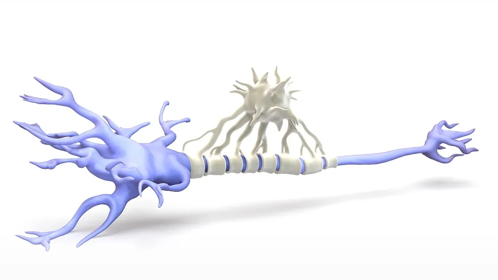 Microglial cell on neuron