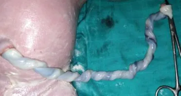 Human Umbilical Cord Blood Metabolites Lengthen Worms’ Lives