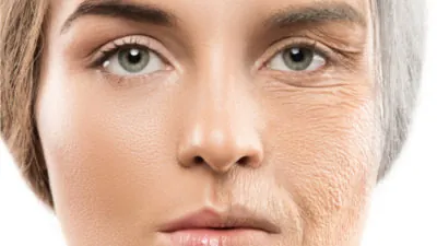 Aged skin