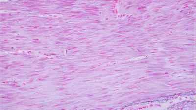 Microscope image of smooth muscle cells