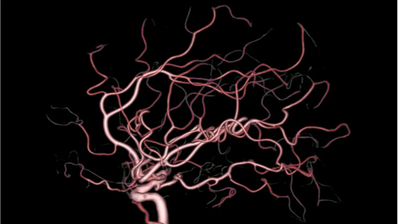 Brain vasculature