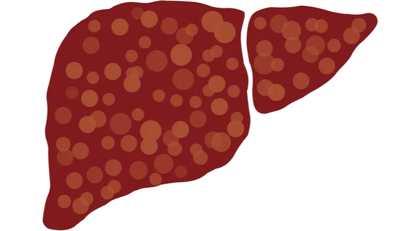 Fibrotic liver