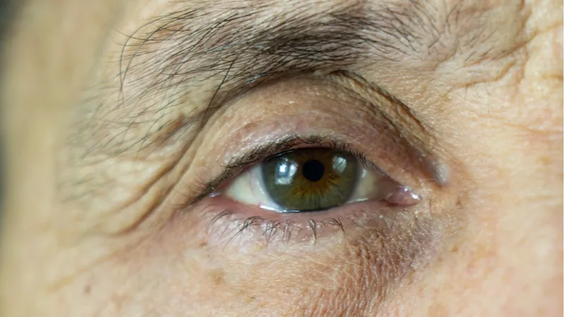 Old man eye