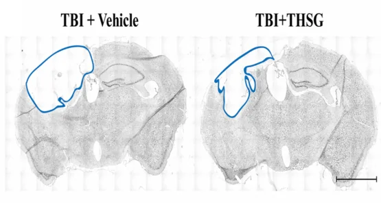 Mouse TBI