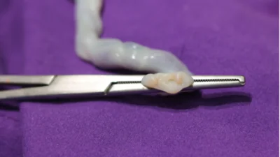 Umbilical Cord