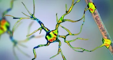 An Unexplored Link Between Inflammation and Alzheimer’s