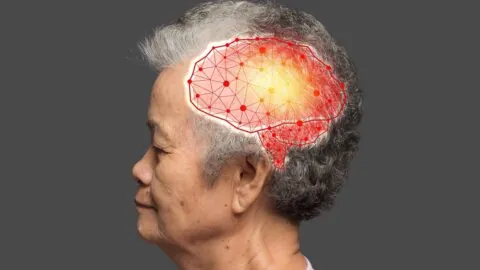 Elderly brain