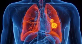 A Protein Potently Suppresses Lung Cancer in Mice
